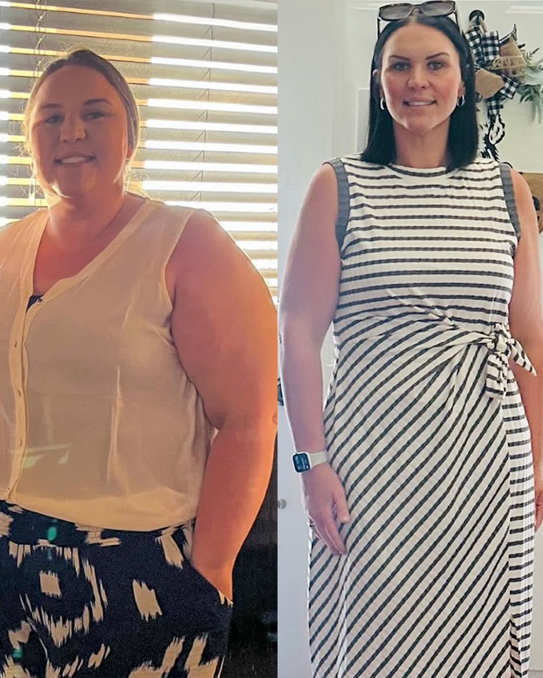Transformation