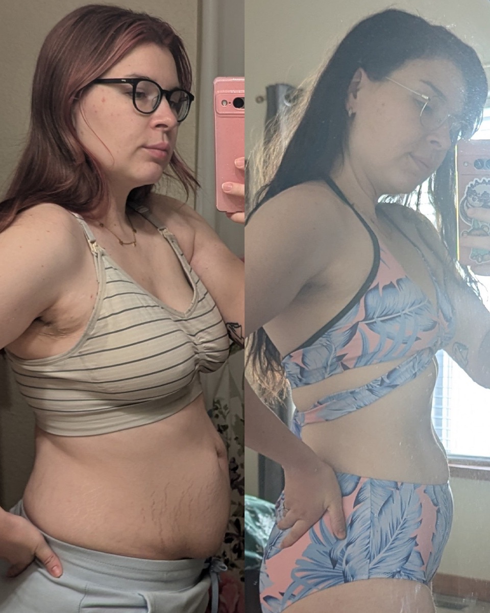 Bethany transformation